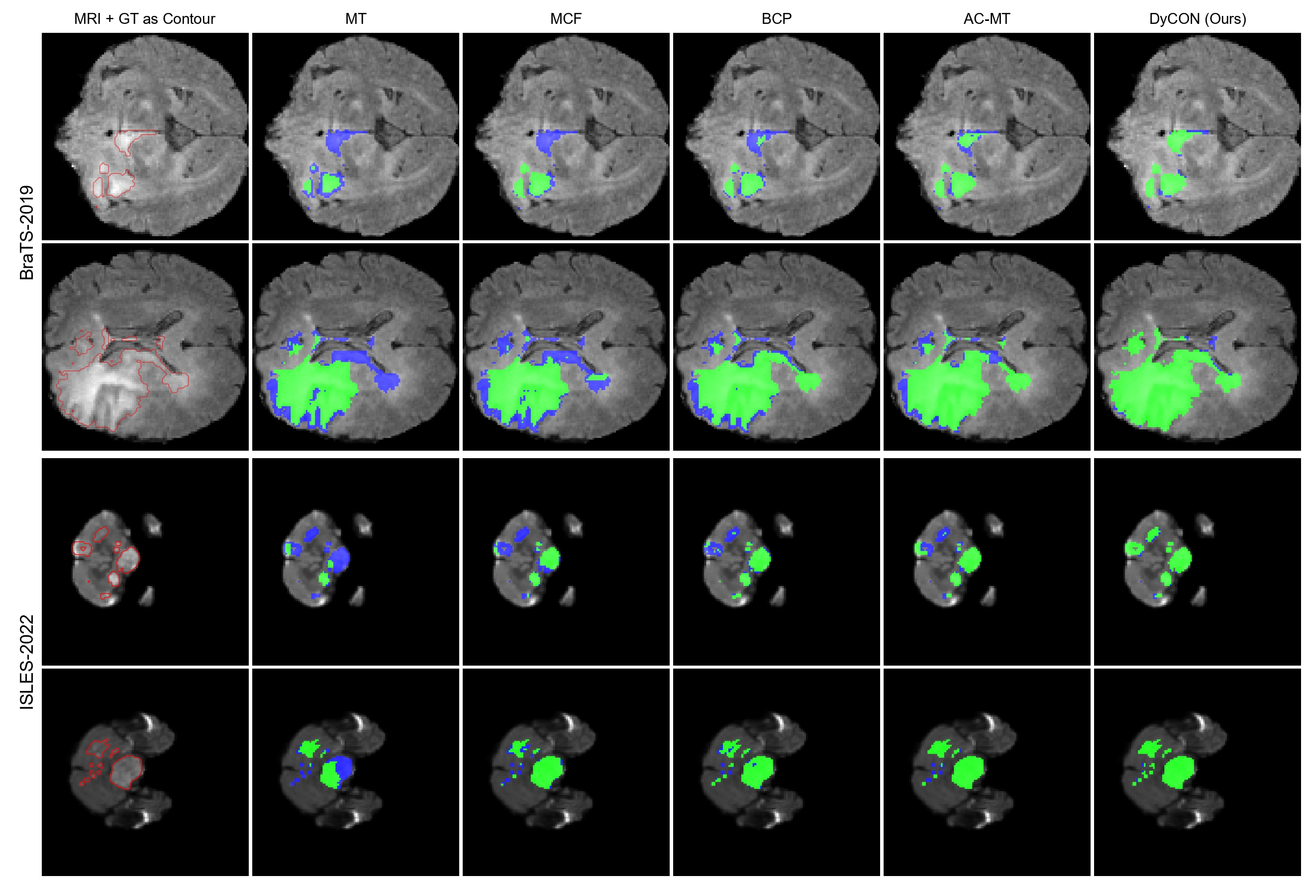DyCON Segmentation Results